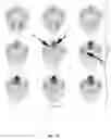 Fig. 13 - Diagnosing reflux disease