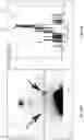 Fig. 14 - Diagnosing reflux disease