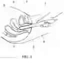 Fig. 02 - METHODS FOR BIOMECHANICAL MAPPING OF THE FEMALE PELVIC FLOOR