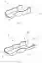 Fig. 02 - Intraoral device for creating a sensation of contact, method for applying an intraoral device, and method for determining the thickness of an intraoral device