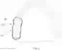 Fig. 04 - Intraoral device for creating a sensation of contact, method for applying an intraoral device, and method for determining the thickness of an intraoral device