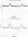 Fig. 16 - Systems and methods for maternal uterine activity detection