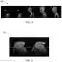 Fig. 05 - Plane selection using localizer images