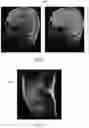 Fig. 06 - Plane selection using localizer images