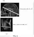 Fig. 07 - Plane selection using localizer images