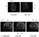 Fig. 08 - Plane selection using localizer images