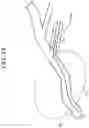 Fig. 15 - X-ray diagnosis apparatus comprising a blood vessel running information acquiring function, a position specification function, and a diaphragm control function