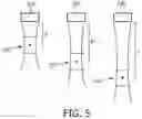 Fig. 05 - FOCUS TRACKING IN ULTRASOUND SYSTEM FOR DEVICE TRACKING