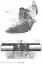 Fig. 12 - Modular ultrasound apparatus and methods