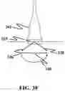 Fig. 10 - GENERATING A SOURCE POINT OF SHEAR WAVES FOR SHEAR WAVE ELASTICITY IMAGING