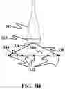 Fig. 12 - GENERATING A SOURCE POINT OF SHEAR WAVES FOR SHEAR WAVE ELASTICITY IMAGING