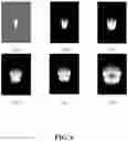 Fig. 17 - GENERATING A SOURCE POINT OF SHEAR WAVES FOR SHEAR WAVE ELASTICITY IMAGING