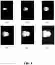 Fig. 19 - GENERATING A SOURCE POINT OF SHEAR WAVES FOR SHEAR WAVE ELASTICITY IMAGING