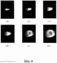 Fig. 20 - GENERATING A SOURCE POINT OF SHEAR WAVES FOR SHEAR WAVE ELASTICITY IMAGING