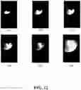 Fig. 23 - GENERATING A SOURCE POINT OF SHEAR WAVES FOR SHEAR WAVE ELASTICITY IMAGING