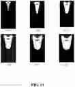 Fig. 24 - GENERATING A SOURCE POINT OF SHEAR WAVES FOR SHEAR WAVE ELASTICITY IMAGING