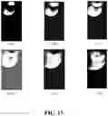 Fig. 26 - GENERATING A SOURCE POINT OF SHEAR WAVES FOR SHEAR WAVE ELASTICITY IMAGING
