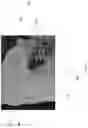 Fig. 08 - METHODS AND APPARATUSES FOR GUIDING COLLECTION OF ULTRASOUND DATA USING MOTION AND/OR ORIENTATION DATA
