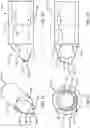 Fig. 09 - TISSUE REMOVAL AND COLLECTION DEVICES