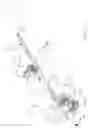 Fig. 07 - Core needle biopsy device for collecting multiple samples in a single insertion