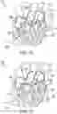 Fig. 10 - Methods for occluding or promoting fluid flow