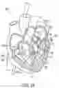 Fig. 13 - Methods for occluding or promoting fluid flow