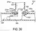 Fig. 16 - Methods for occluding or promoting fluid flow