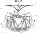 Fig. 11 - Uncoupled LAA device