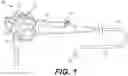 Fig. 02 - Devices and methods for endoscopic patch delivery