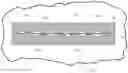 Fig. 01 - Skin closure devices with interrupted closure