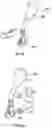 Fig. 14 - Tissue retractor and method of use