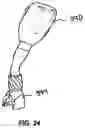 Fig. 15 - Tissue retractor and method of use