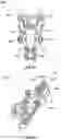 Fig. 16 - Tissue retractor and method of use