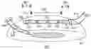 Fig. 01 - Devices for intraocular surgery