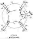 Fig. 11 - Devices for intraocular surgery