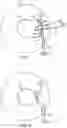 Fig. 12 - Devices for intraocular surgery