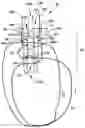 Fig. 01 - Syndesmosis construct