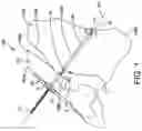 Fig. 02 - Syndesmosis construct