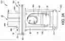 Fig. 03 - Syndesmosis construct