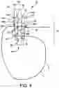 Fig. 07 - Syndesmosis construct