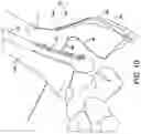Fig. 16 - Syndesmosis construct