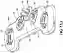 Fig. 18 - Syndesmosis construct
