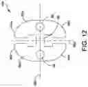 Fig. 20 - Syndesmosis construct