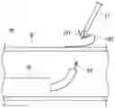 Fig. 01 - Method of delivering and recovering curved needle