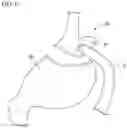 Fig. 08 - Method of delivering and recovering curved needle
