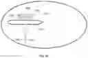 Fig. 12 - Suture guide and related parts, kits, and methods
