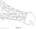 Fig. 05 - Systems for securing sutures