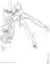 Fig. 32 - Surgical instrument having a feedback system