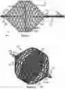Fig. 02 - Vessel occluder