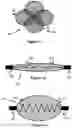 Fig. 07 - Vessel occluder